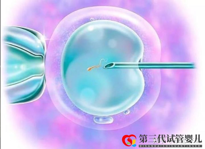 通俗易懂的一、二、三代试管婴儿解说,及三代试管能...(图4) 通俗易懂的一、二、三代试管婴儿解说,及三代试管能...(图4)