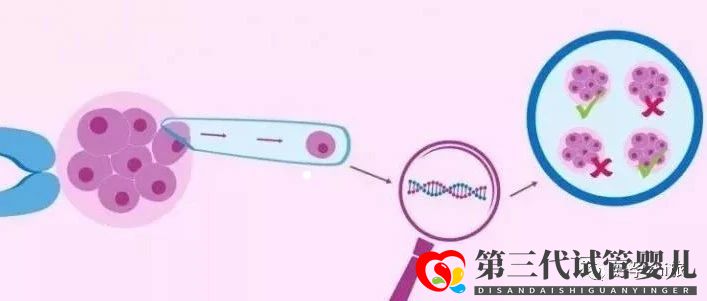 通俗易懂的一、二、三代试管婴儿解说,及三代试管能...(图7) 通俗易懂的一、二、三代试管婴儿解说,及三代试管能...(图7)