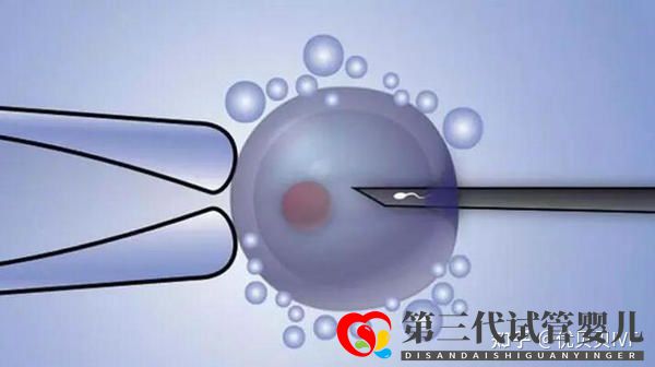国内的三代试管医院都有哪些第一梯队了解下(图3) 国内的三代试管医院都有哪些第一梯队了解下(图3)