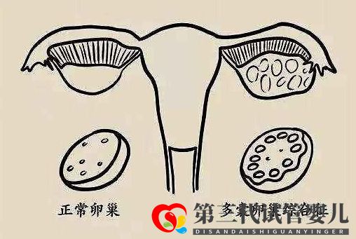 多囊促排怀孕成功率大吗？(图1)