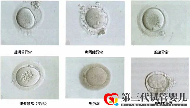 夫妻染色体正常,但胚胎染色体异常,什么原因引起(图10) 夫妻染色体正常,但胚胎染色体异常,什么原因引起(图10)