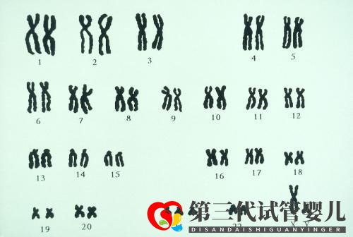 夫妻染色体正常,试管胚胎染色体异常的三个原因你都知道吗?(图1) 夫妻染色体正常,试管胚胎染色体异常的三个原因你都知道吗?(图1)