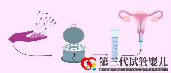 人授还是试管应该怎么选(图2) 人授还是试管应该怎么选(图2)