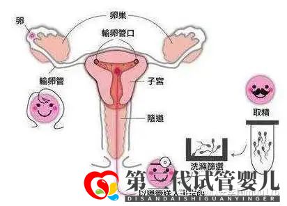 人工授精跟试管婴儿的区别(图10) 人工授精跟试管婴儿的区别(图10)