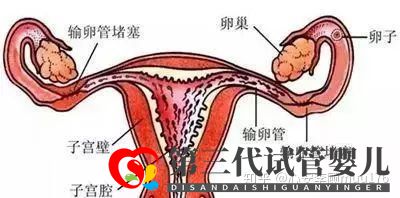 人工授精跟试管婴儿的区别(图5) 人工授精跟试管婴儿的区别(图5)