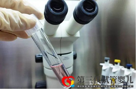人工授精跟试管婴儿的区别(图17) 人工授精跟试管婴儿的区别(图17)