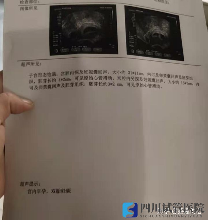 我在成都做三代试管的经历(标图接好孕)(图4) 我在成都做三代试管的经历(标图接好孕)(图4)