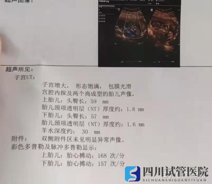 我在成都做三代试管的经历(标图接好孕)(图5) 我在成都做三代试管的经历(标图接好孕)(图5)