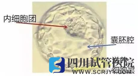 试管婴儿选取移植胚胎的标准是什么(图4) 试管婴儿选取移植胚胎的标准是什么(图4)