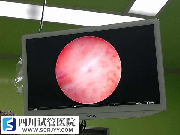 试管婴儿内膜不长反降怎么回事