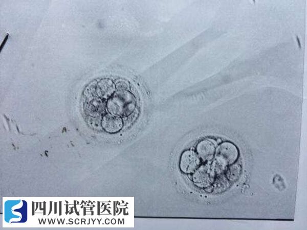 囊胚移植的成功率高于卵裂期胚胎