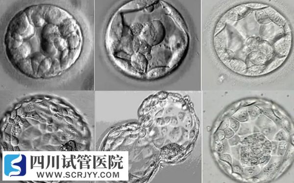 家族遗传会让囊胚分裂成双胞胎
