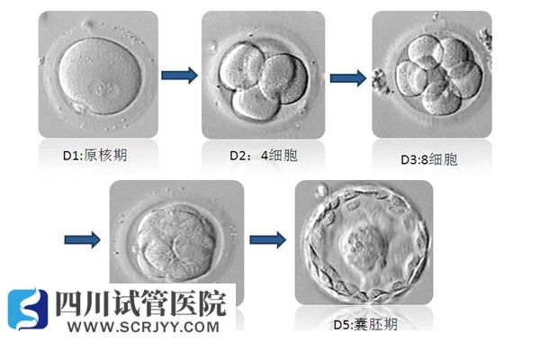 单囊胚变成双胞胎的几率约20%